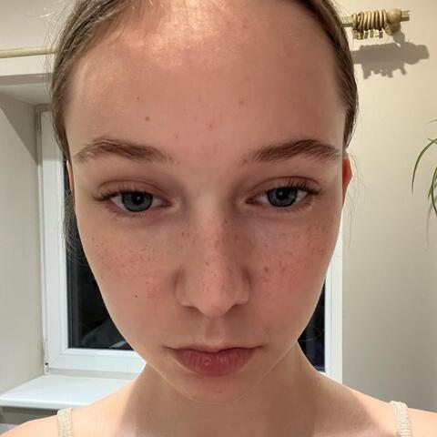 Gustė Burbulytė - Individual - Lithuania - StageLync