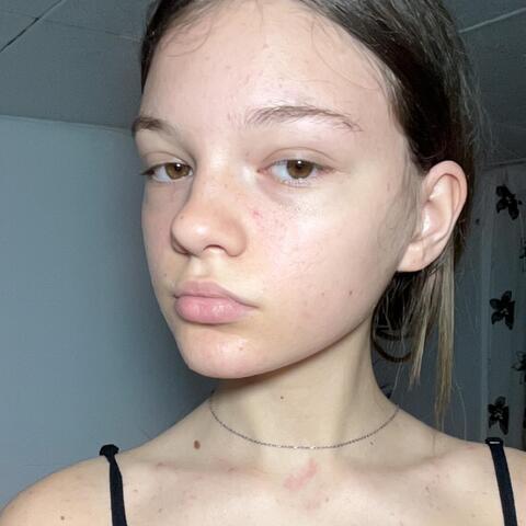 Alejandra Gabriela Stoenescu - Individual - Romania - StageLync